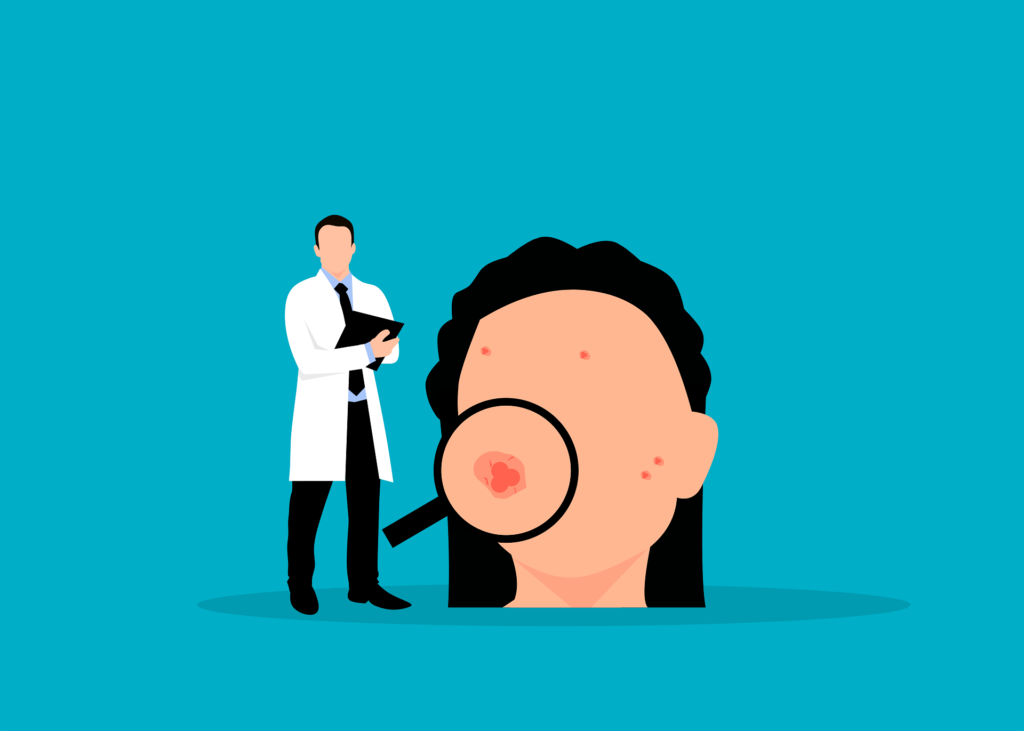 Acne: what it is and how it can be treated?